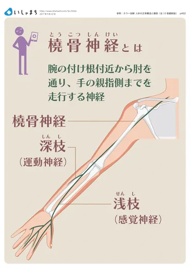 手の関節が伸ばしにくくなる橈骨神経麻痺。どのような治療をする?–いしゃまち