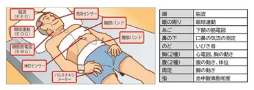睡眠時無呼吸症候群（SAS）対策と企業経営 