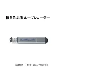 植え込み型ループレコーダー(ILR)でわかる！原因不明の失神、その謎を解くとは！？